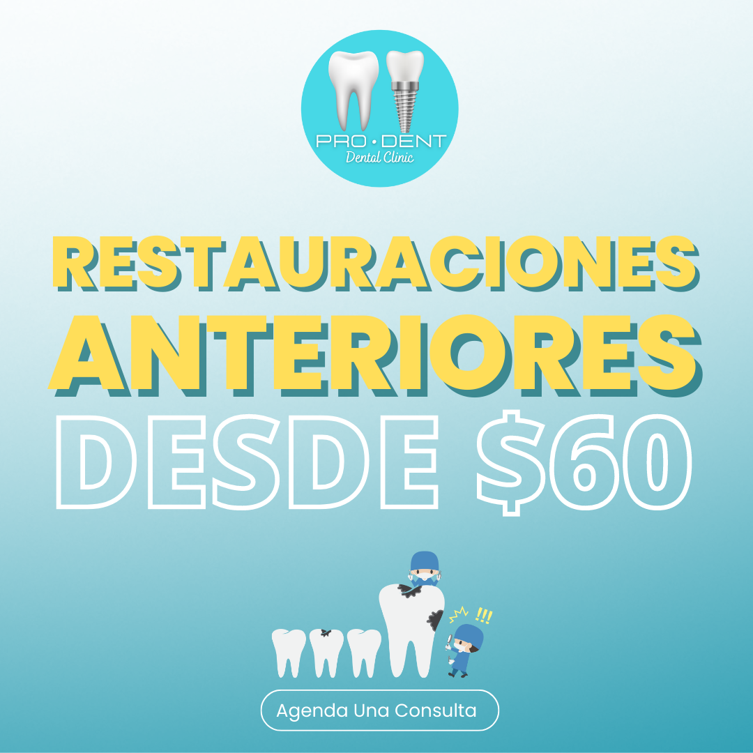 Calzas Frontales (Restauraciones Anteriores)