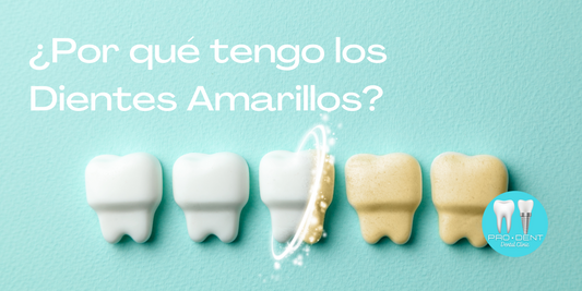 ¿Por qué tengo los Dientes Amarillos?
