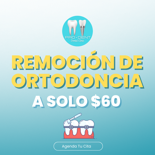 Remoción de Ortodoncia