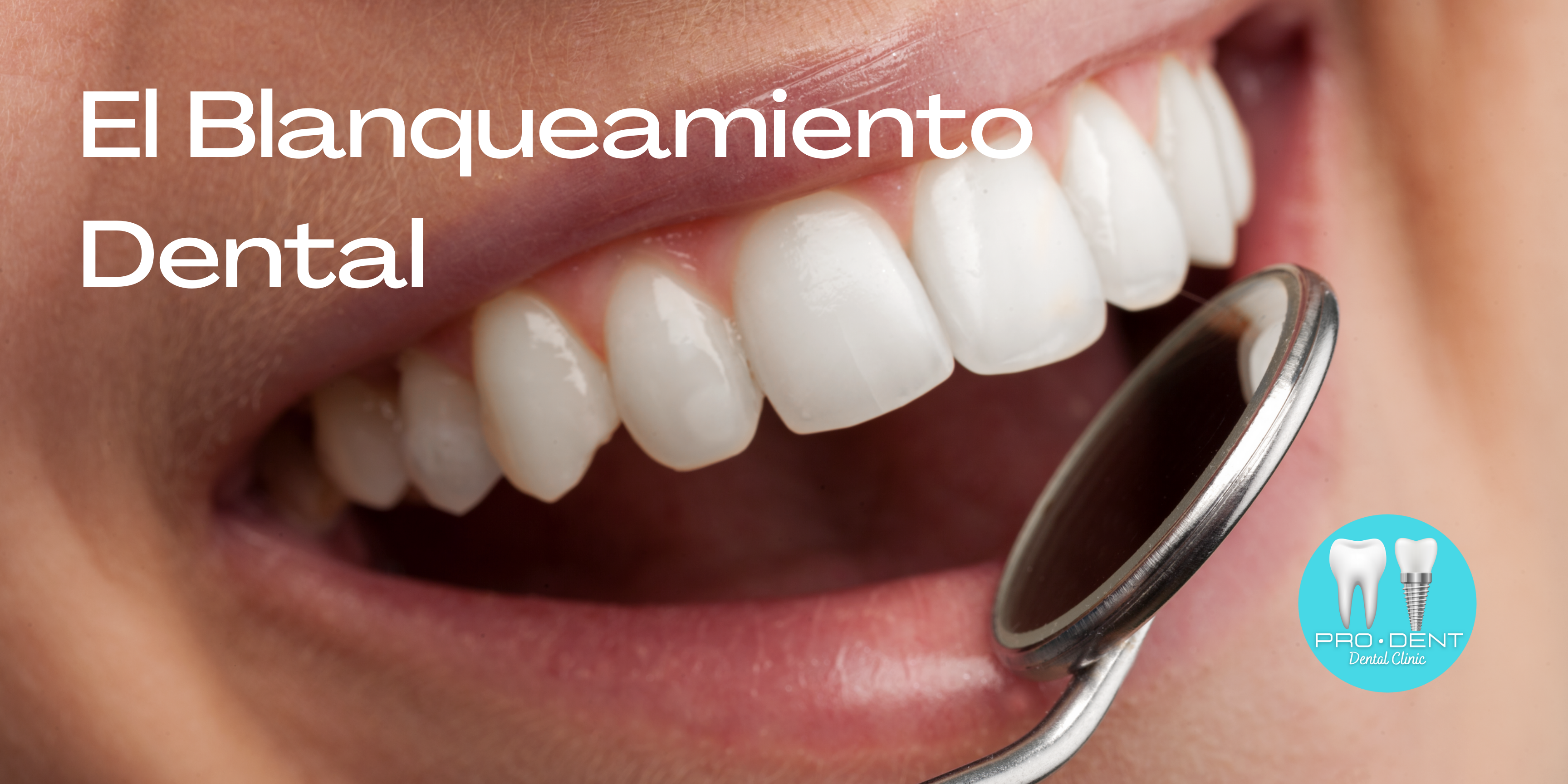 Cargar video: 