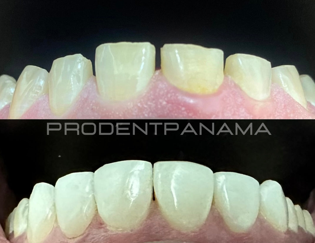 Diseño de Sonrisa