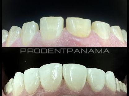 Diseño de Sonrisa